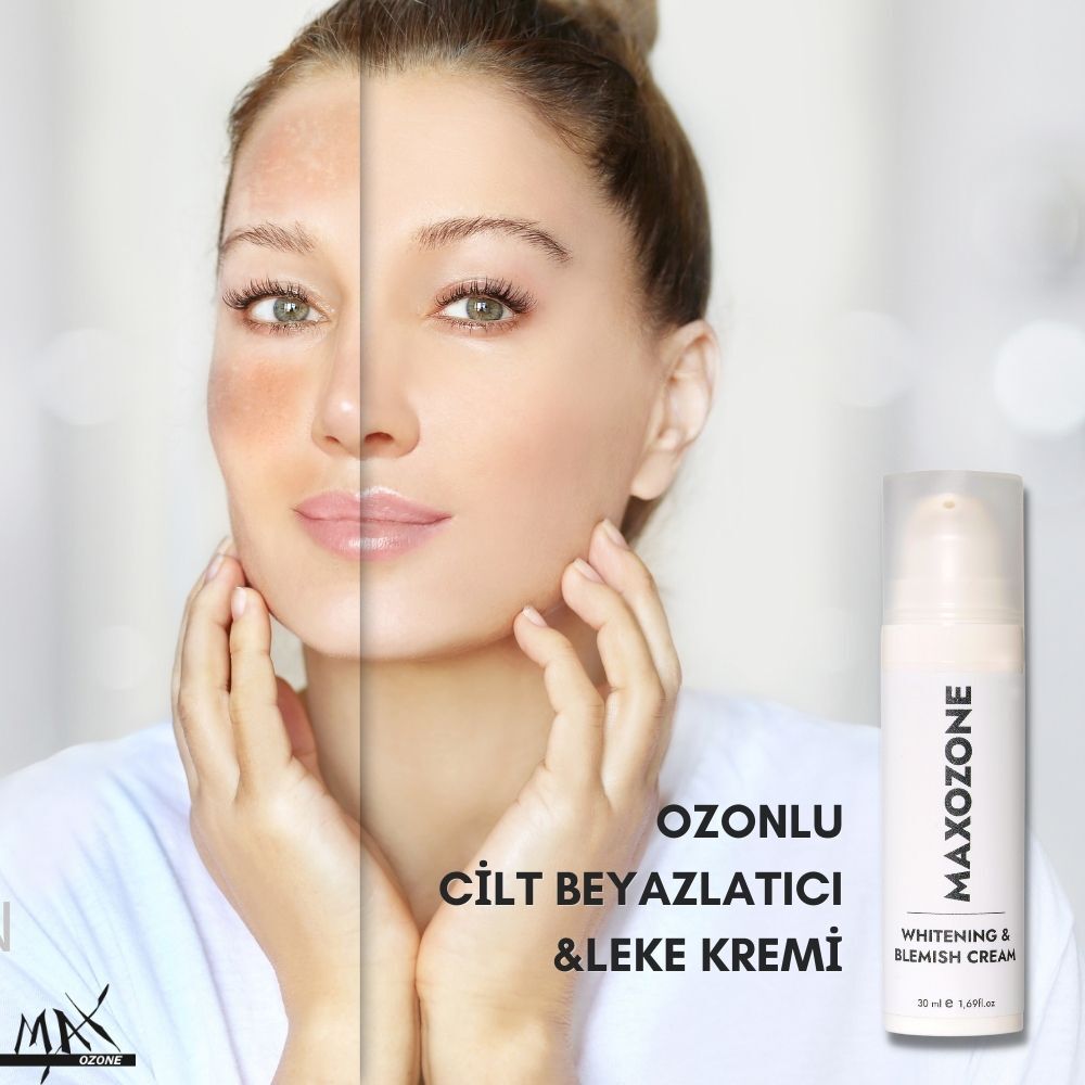 MaxOzone Cilt Beyazlatıcı ve Leke Kremi - Whitening and Blemish Cream